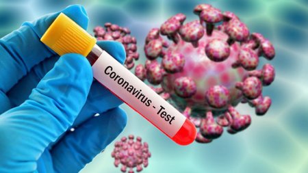 Həkim: Koronavirusu PZR analizi olmadan təyin etmək mümkün deyil